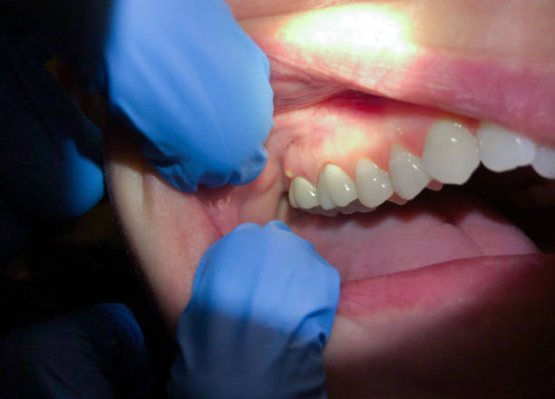 Best Broken or Chipped Tooth Repair in Greenville, TX